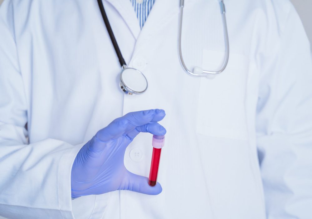 caucasian doctor man holding test tube with blood for 2019-nCoV analyzing. Chinese Coronavirus blood test concept. Covid-2019 Osoba ubrana w biały fartuch laboratoryjny oraz niebieskie rękawiczki ochronne trzyma w dłoni probówkę wypełnioną czerwonym płynem, co może sugerować próbkę krwi lub innego materiału biologicznego. Na szyi zawieszony jest stetoskop, co wskazuje na medyczny lub diagnostyczny charakter pracy. Tło jest neutralne, bez wyraźnych elementów rozpraszających uwagę, co pozwala skupić się na czynności związanej z analizą lub badaniem laboratoryjnym.